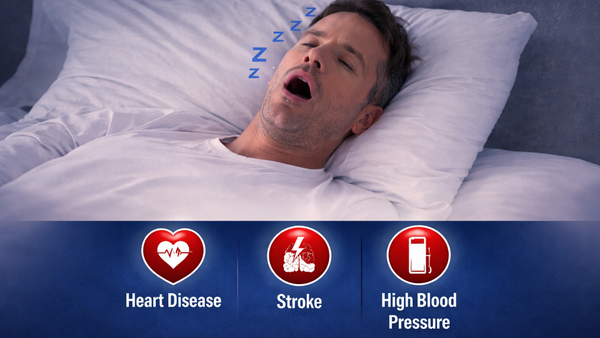Sleep Apnea in 2026: Symptoms, Treatment & Best CPAP Machines Compared